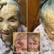 This is too risky”: 107YO went viral because the 4-inch “Longevity Horn” growing on her forehead was said to be due to… see more